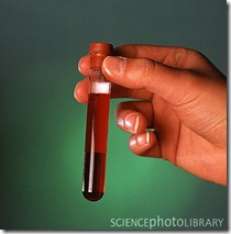 Windows-Live-Writer-Hepatitis-C-testing-recommended-for-boom_6489-test-tube_containing_blood_sample-SPL_thumb